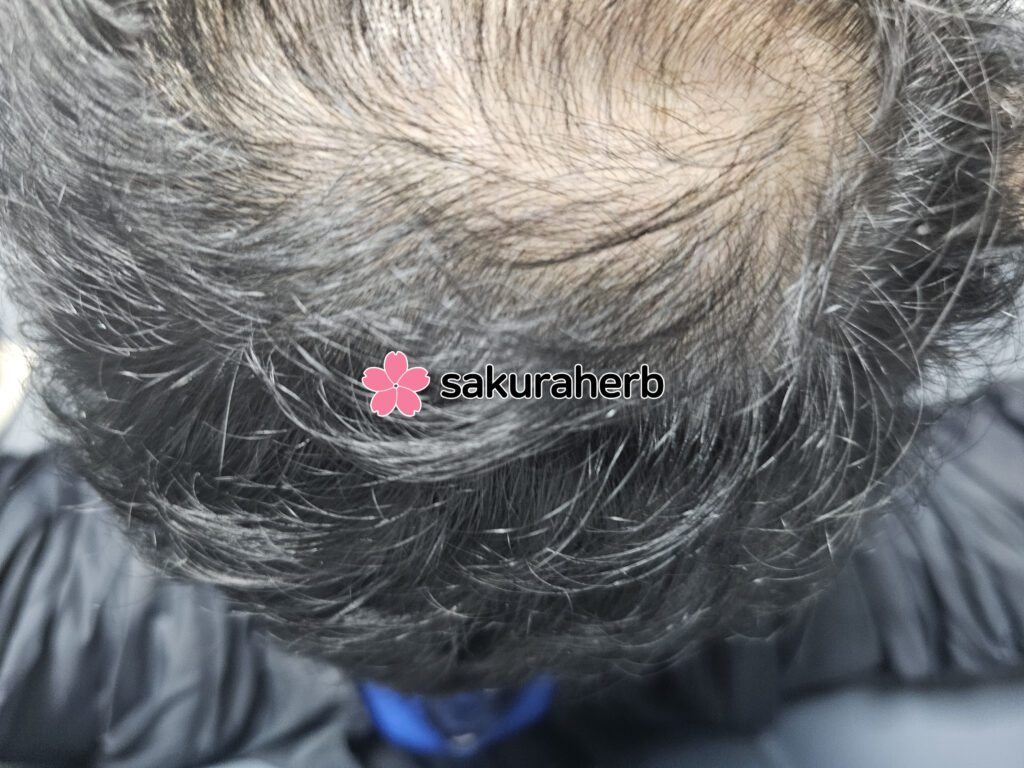 ${review_item.post_title}