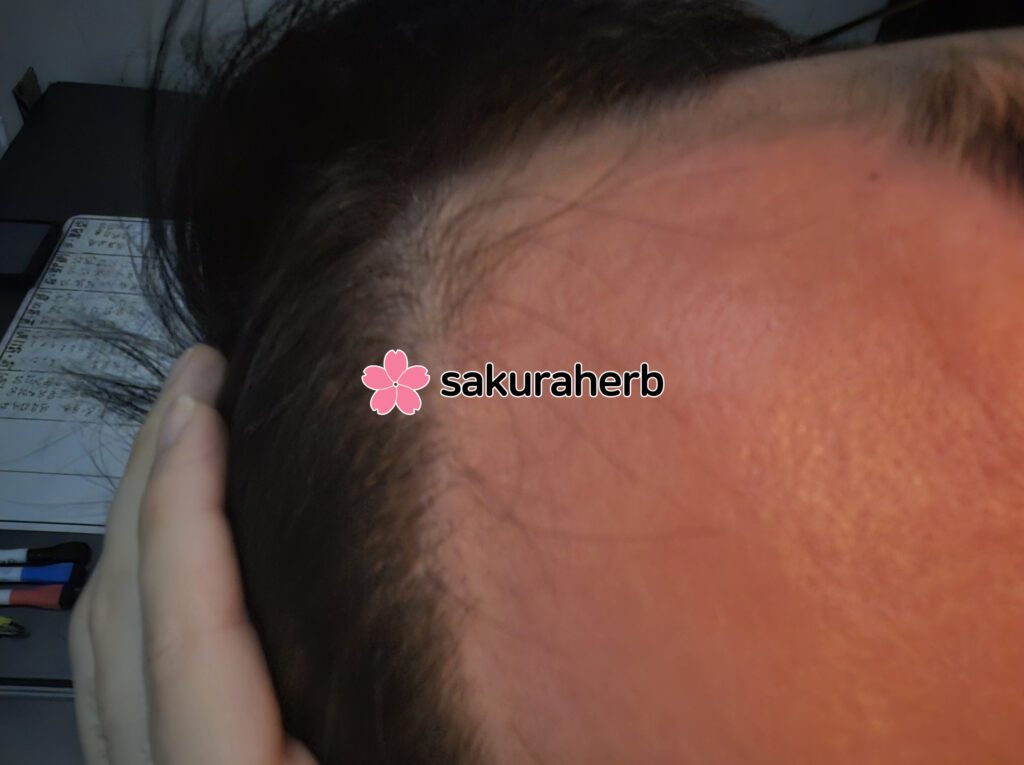 ${review_item.post_title}