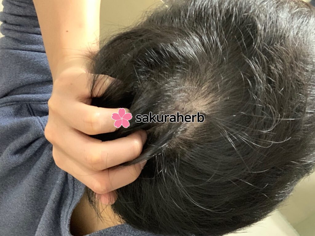 ${review_item.post_title}