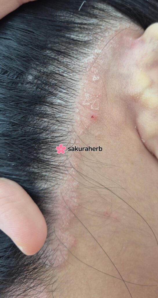 ${review_item.post_title}