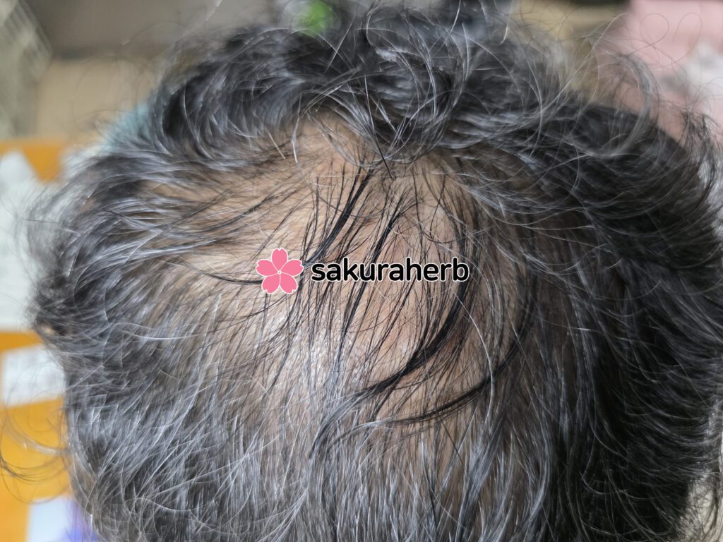 ${review_item.post_title}