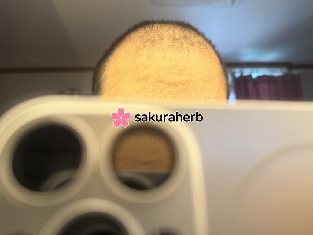 ${review_item.post_title}