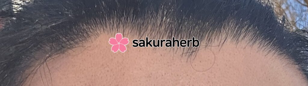 ${review_item.post_title}